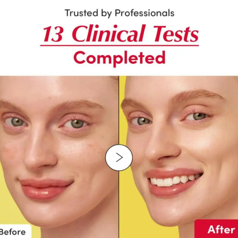 Bakuchiol Plumping Serum And Vitamin C Brightening Serum